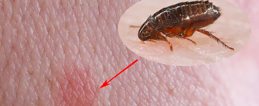 Flea Control for Humans Southlake, TX